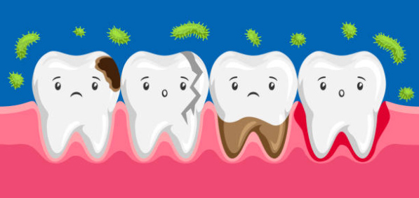 乳歯がむし歯になりやすい理由とは？