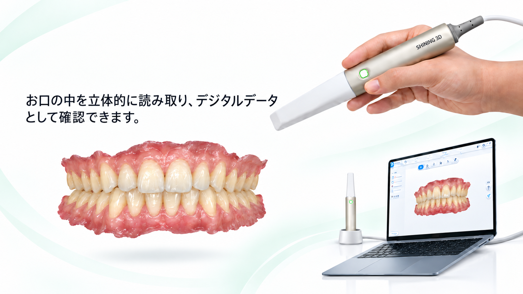 口腔内スキャナー